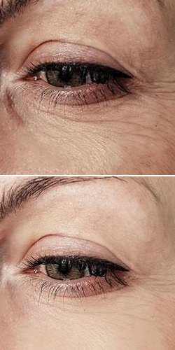 head-before-after